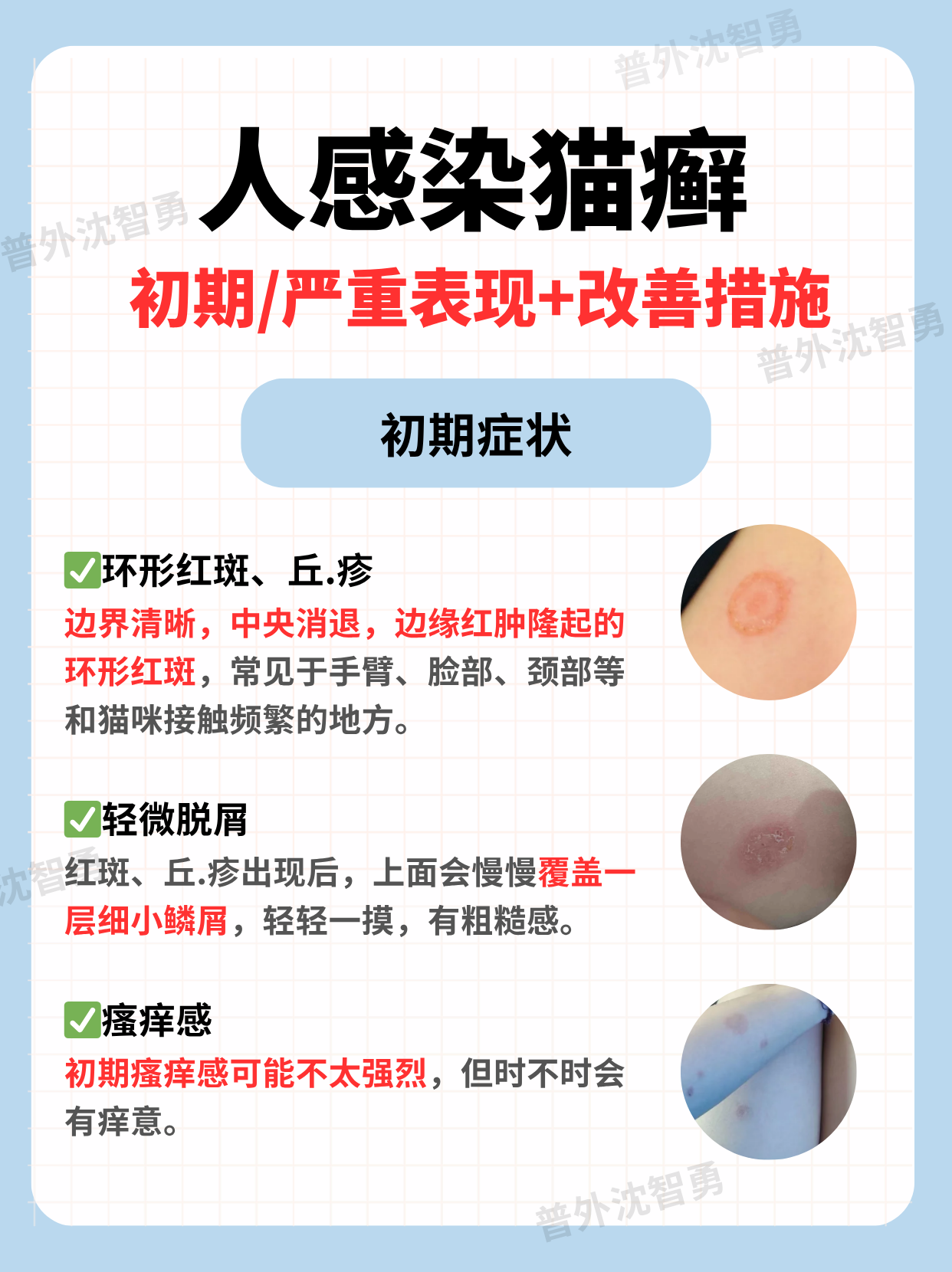 猫藓长什么样猫癣在人身上症状 初期人得猫癣怎么分辨人得猫癣会扩散