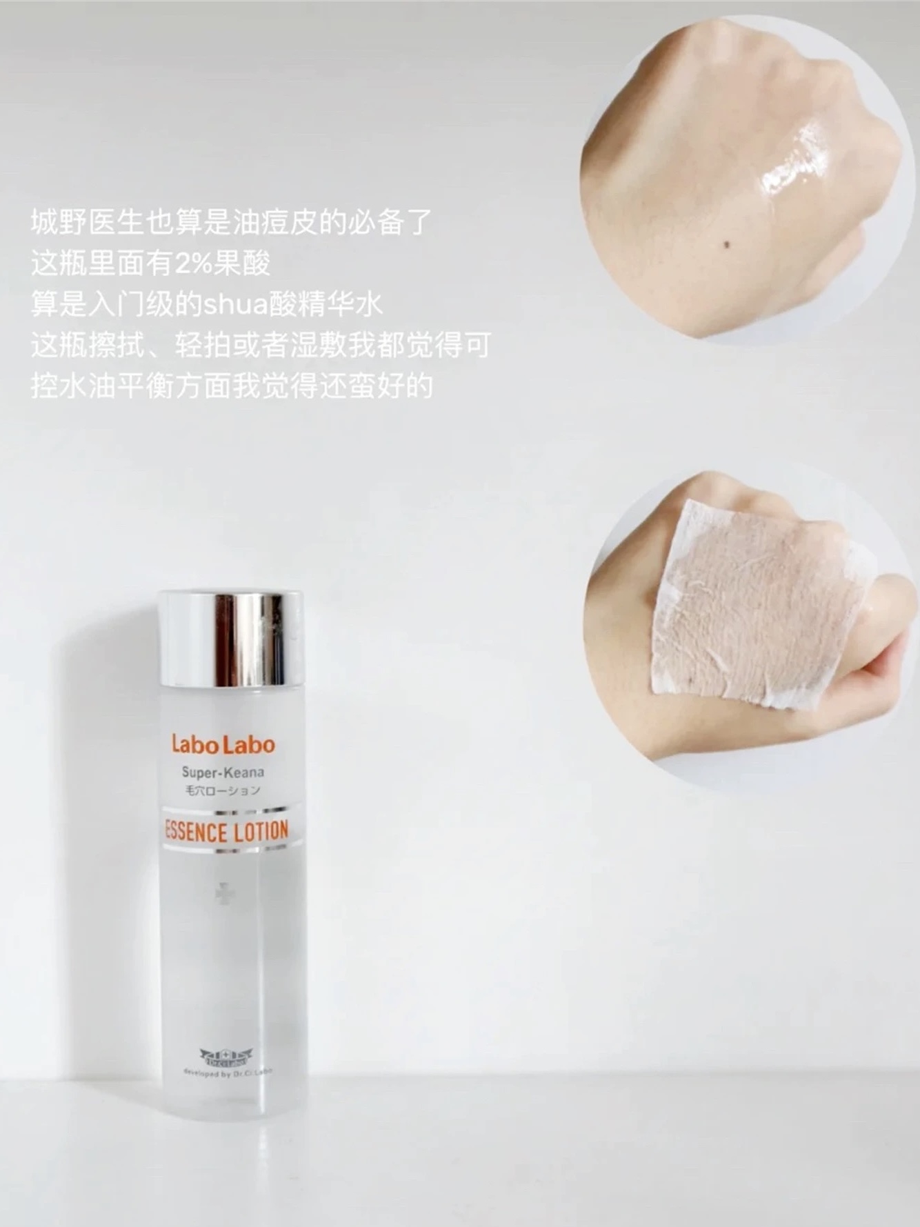wu/达尔肤 8杏仁酸精华 杏仁酸算是比较温和的了 可以改善闭口痘痘的