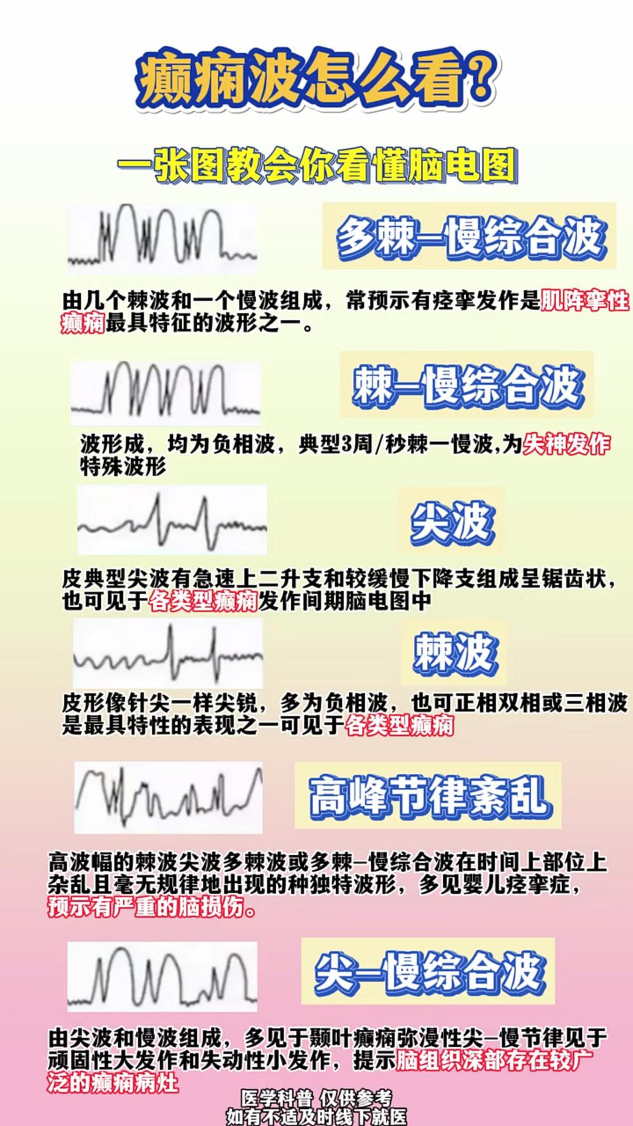 脑电图异常波解读图片