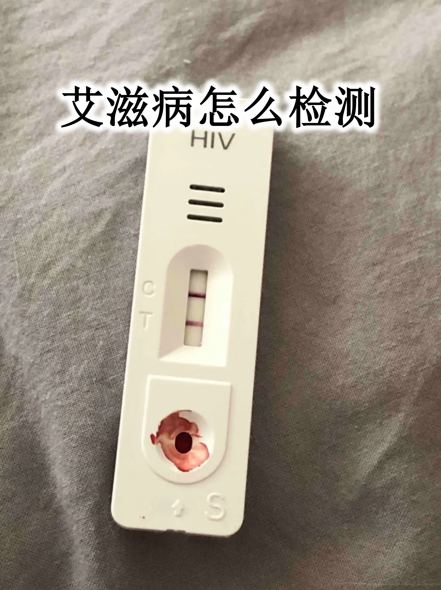 常见检测方法 抗体检测:通过血液或口腔黏膜样本检测hiv抗体,窗口期