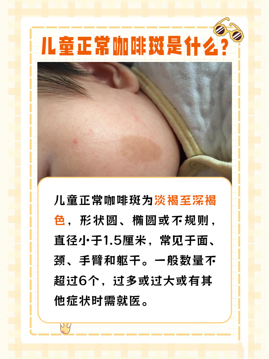 特征了解不够全面,准确识别这些特点对于判断孩子的皮肤状况非常重要