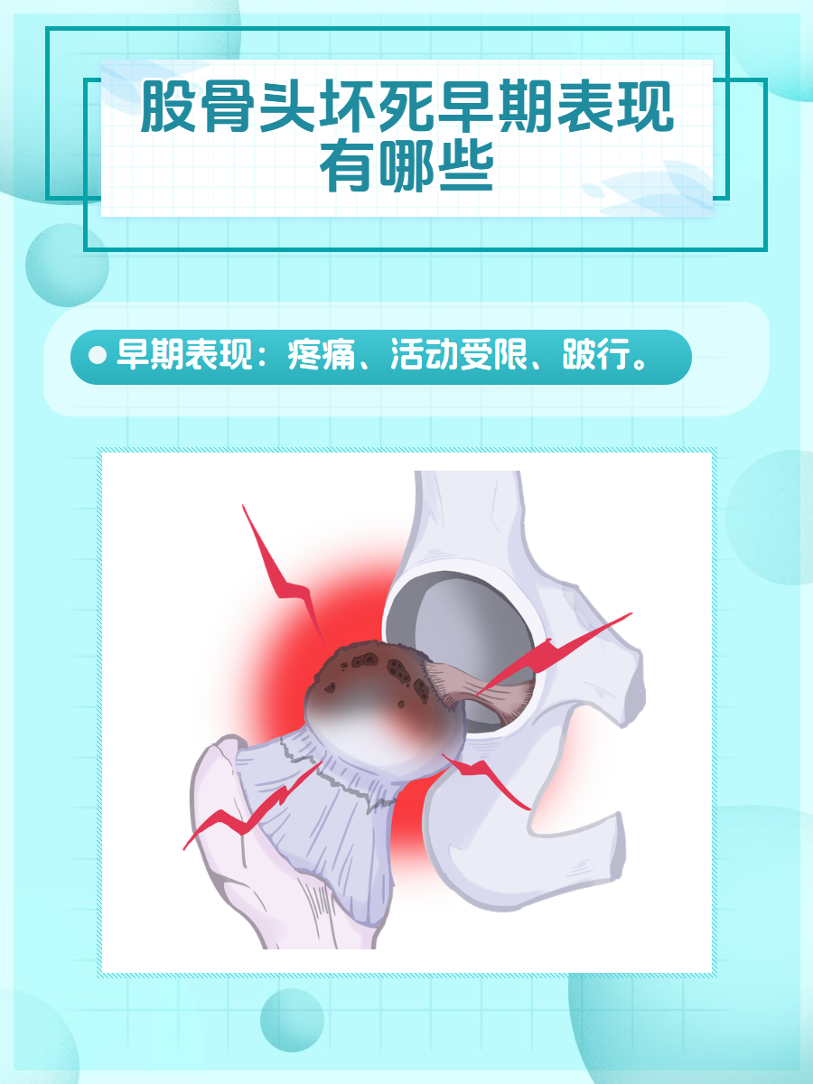 股骨头坏死早期症状图片