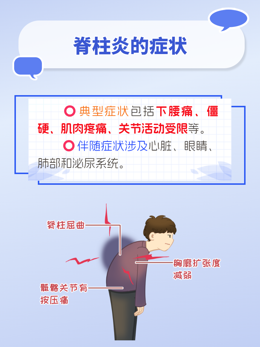 解析这些常见的症状  脊柱炎,一种可能影响你日常活动的慢性炎症性