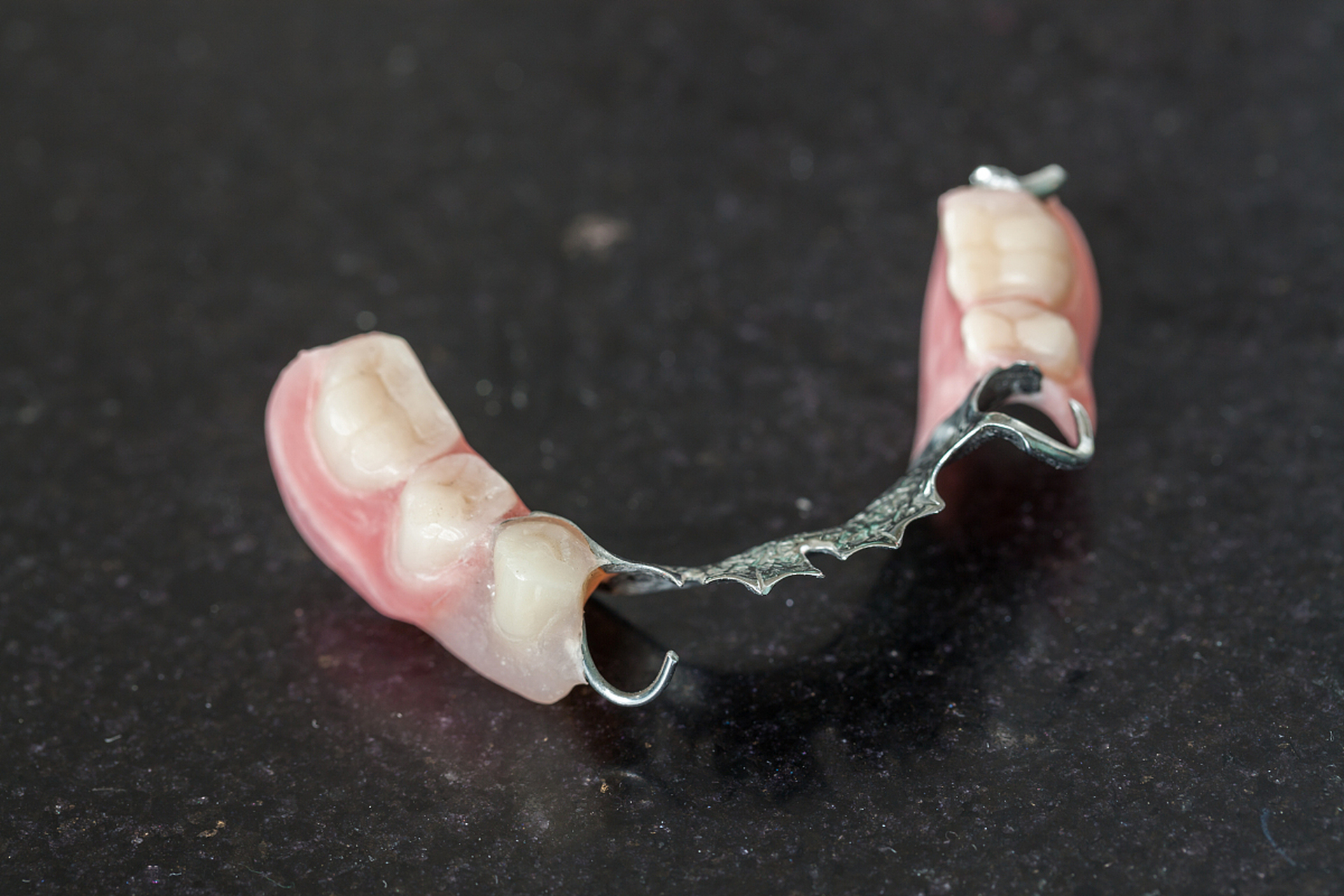 活动义齿是一种可移动的假牙,而种植牙则是通过植入牙槽骨中的人工