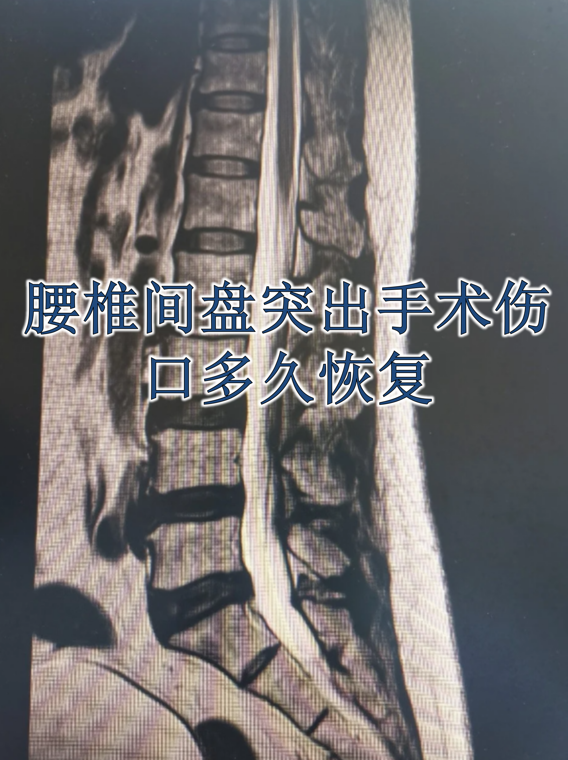 包含安贞医院代取报告代挂号出院居家护理提醒,科学恢复身体的词条 包含安贞医院代取报告代挂号出院居家护理提醒,科学恢复身体的词条