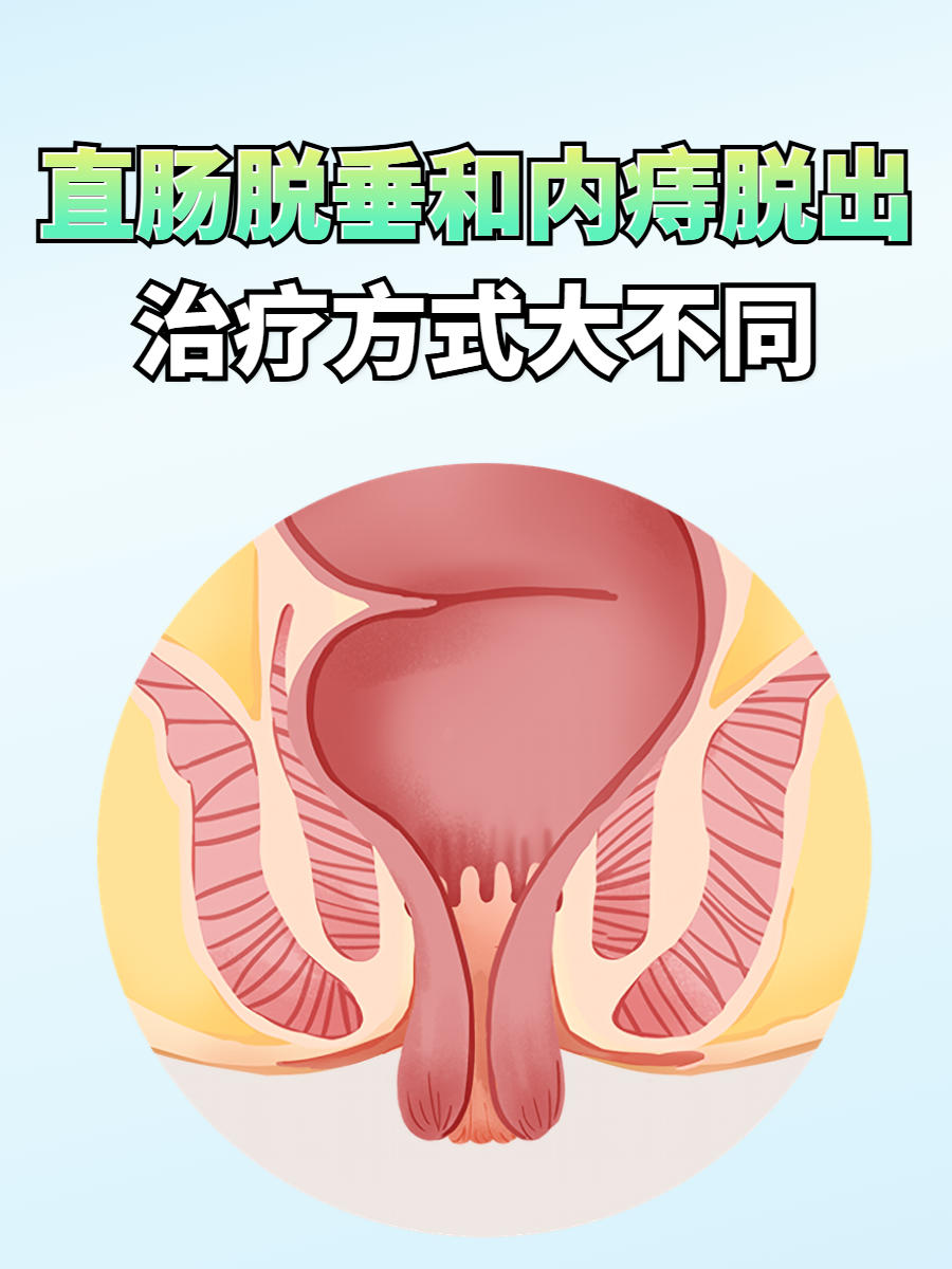 直肠脱垂和内痔脱出都可能表现为肛门有肿物脱出