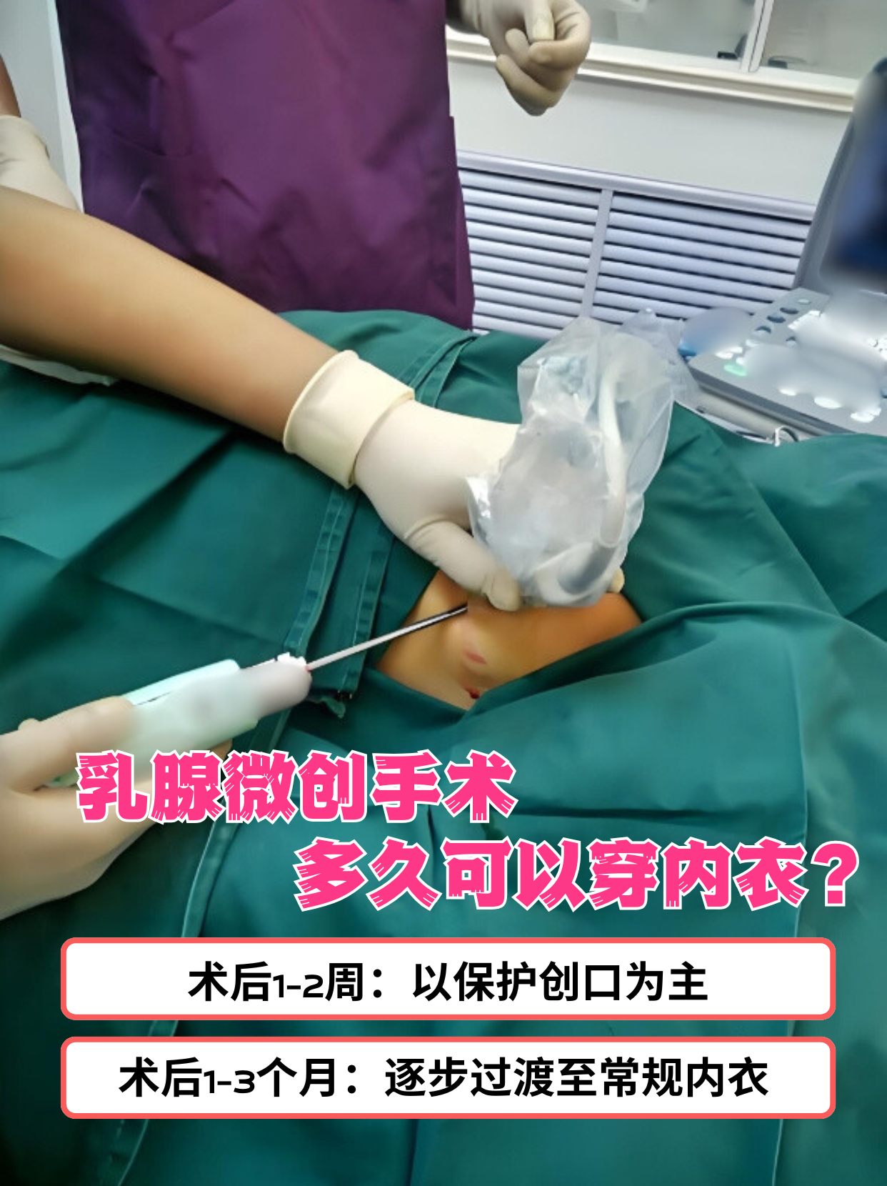 然而,术后多久可以穿内衣,却是许多患者关心的问题