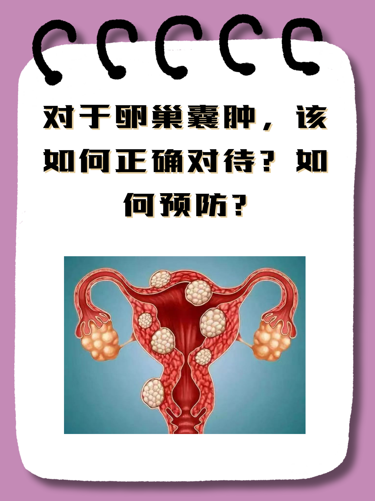 卵巢囊肿一般几年消失百科在线