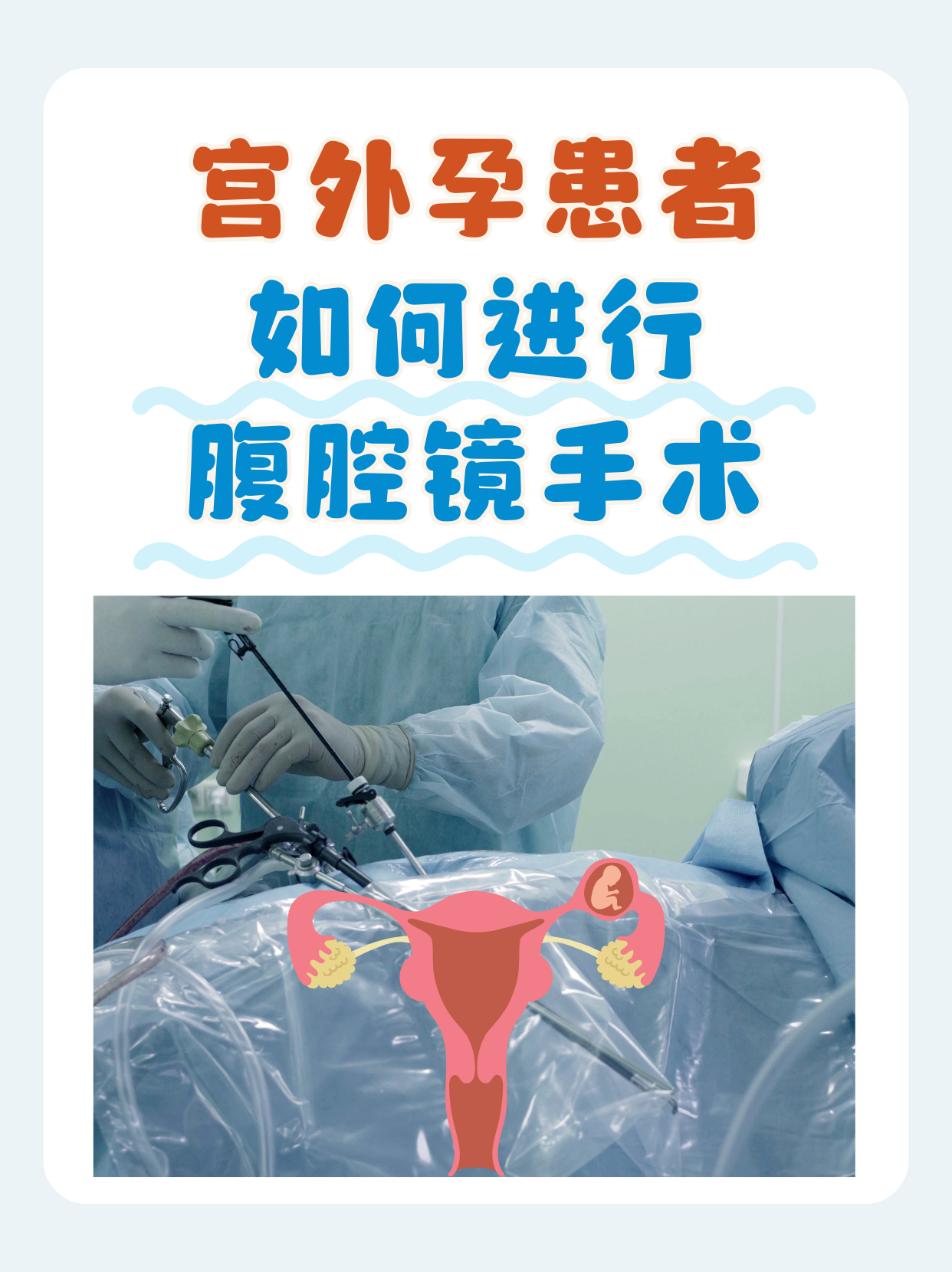 宫外孕患者如何进行腹腔镜手术?