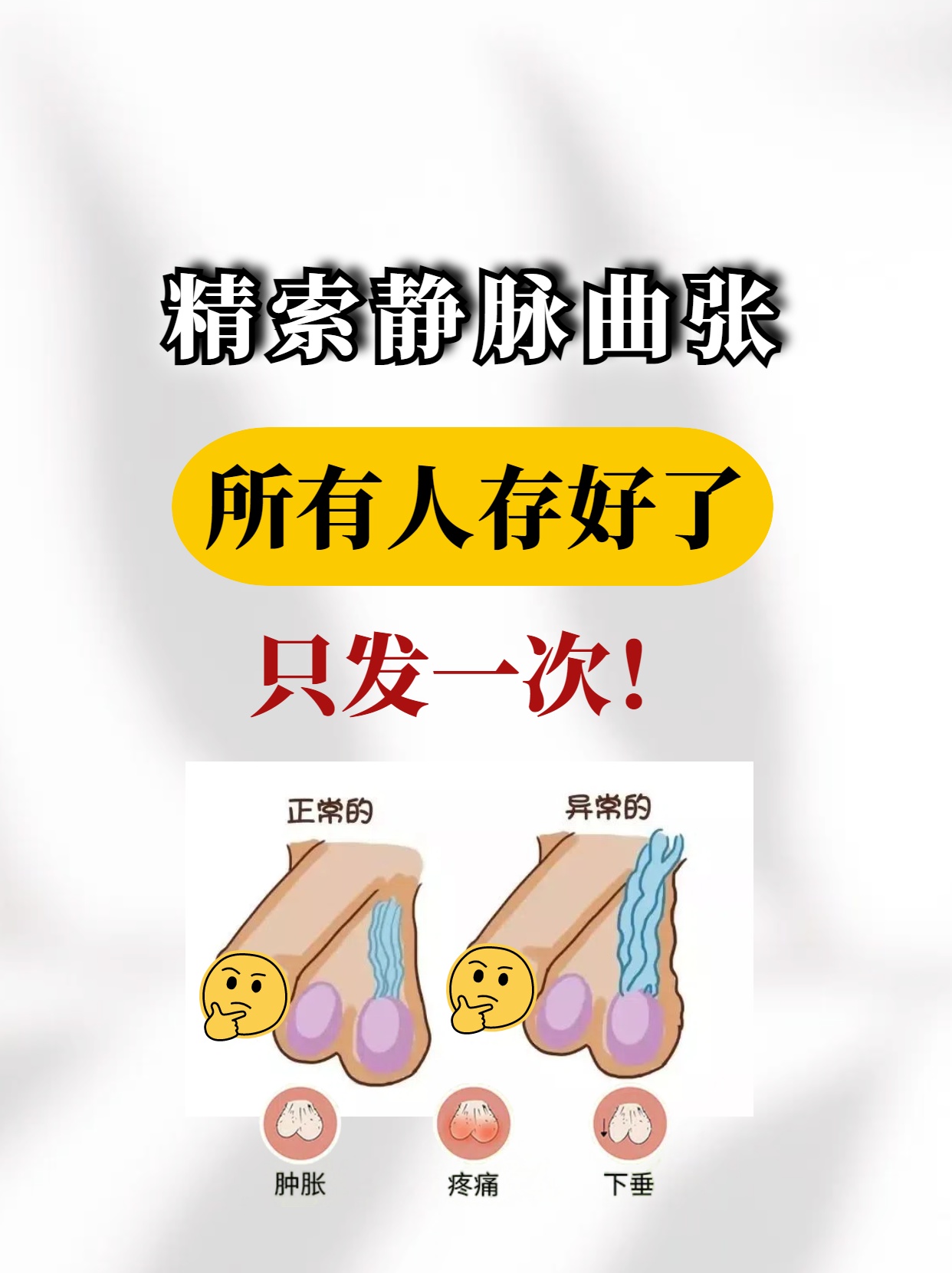 保卫精索静脉曲张,从日常小事做起