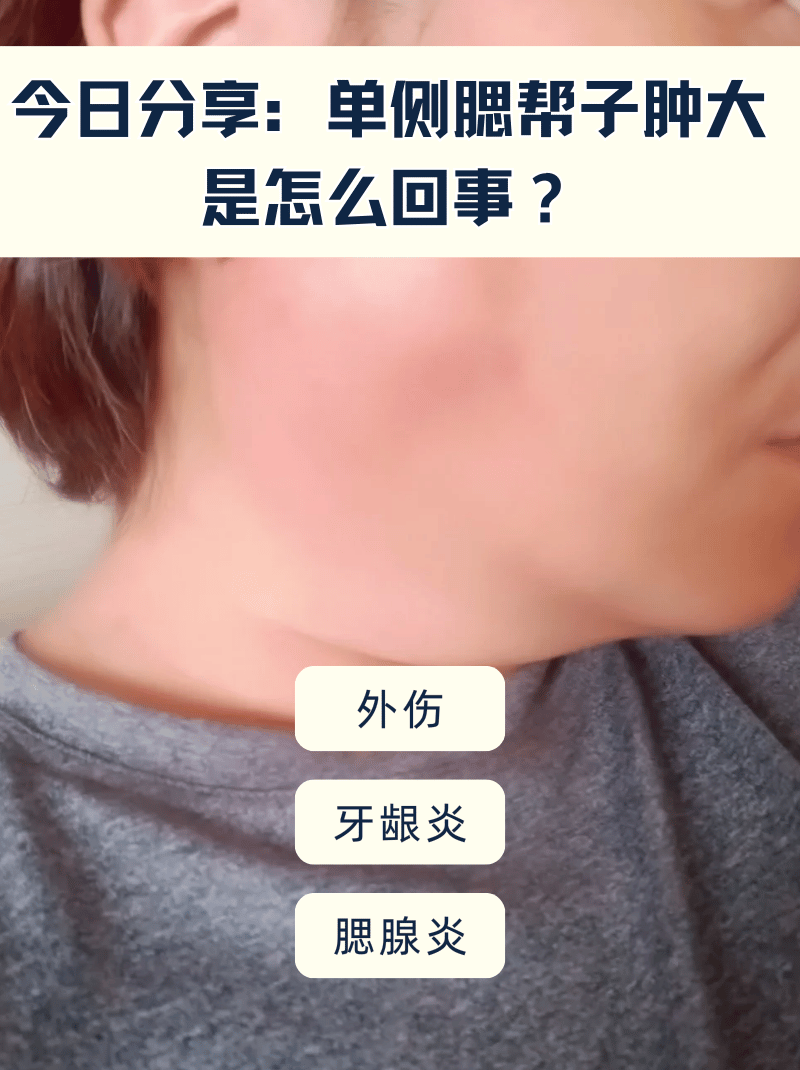 脸部的单侧,腮帮子出现肿胀的情况,别着急!