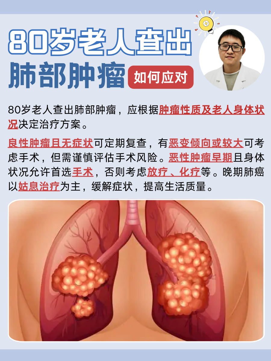 肺部肿瘤是指生长在肺组织中的异常肿块.