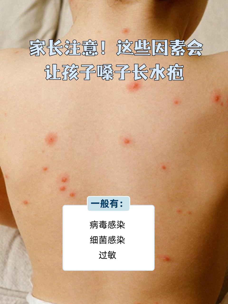 孩子嗓子里边有水疱的常见原因 病毒感染:肠道病毒引发的疱疹性芽峡