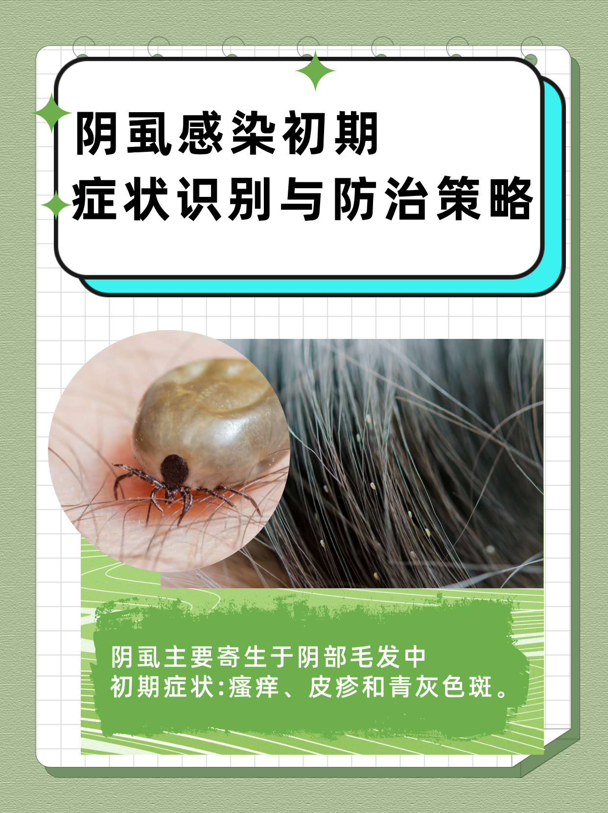 阴虱,作为一种常见的寄生虫感染,主要寄生于人体的阴部毛发中,可有