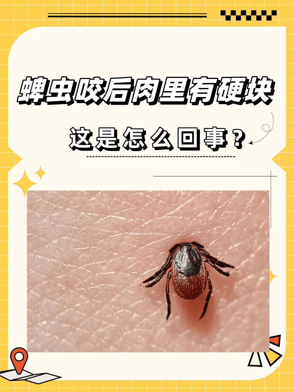 蜱虫是一种寄生虫,它们通过咬宿主来吸取血液