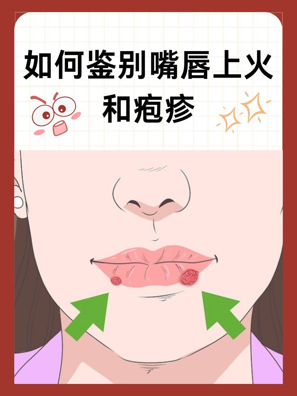 如何鉴别嘴唇上火和疱疹