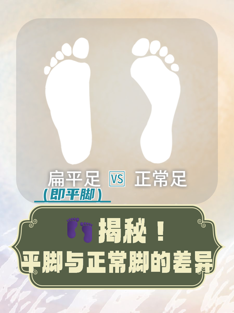 我们常听到"平脚"和"正常脚"的说法,但你知道它们之间到底有哪些区别