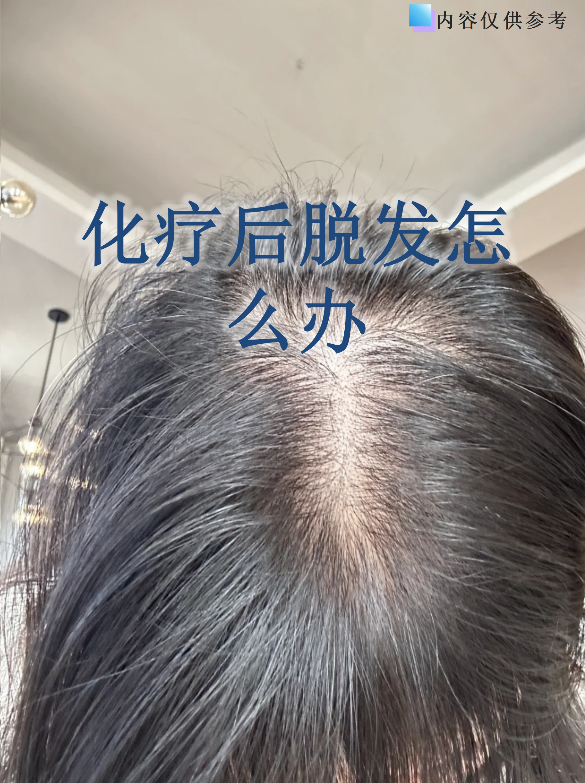 化疗为什么掉头发这对身体有害处吗为什么在线 化疗为什么掉头发这对身体有害处吗为什么在线