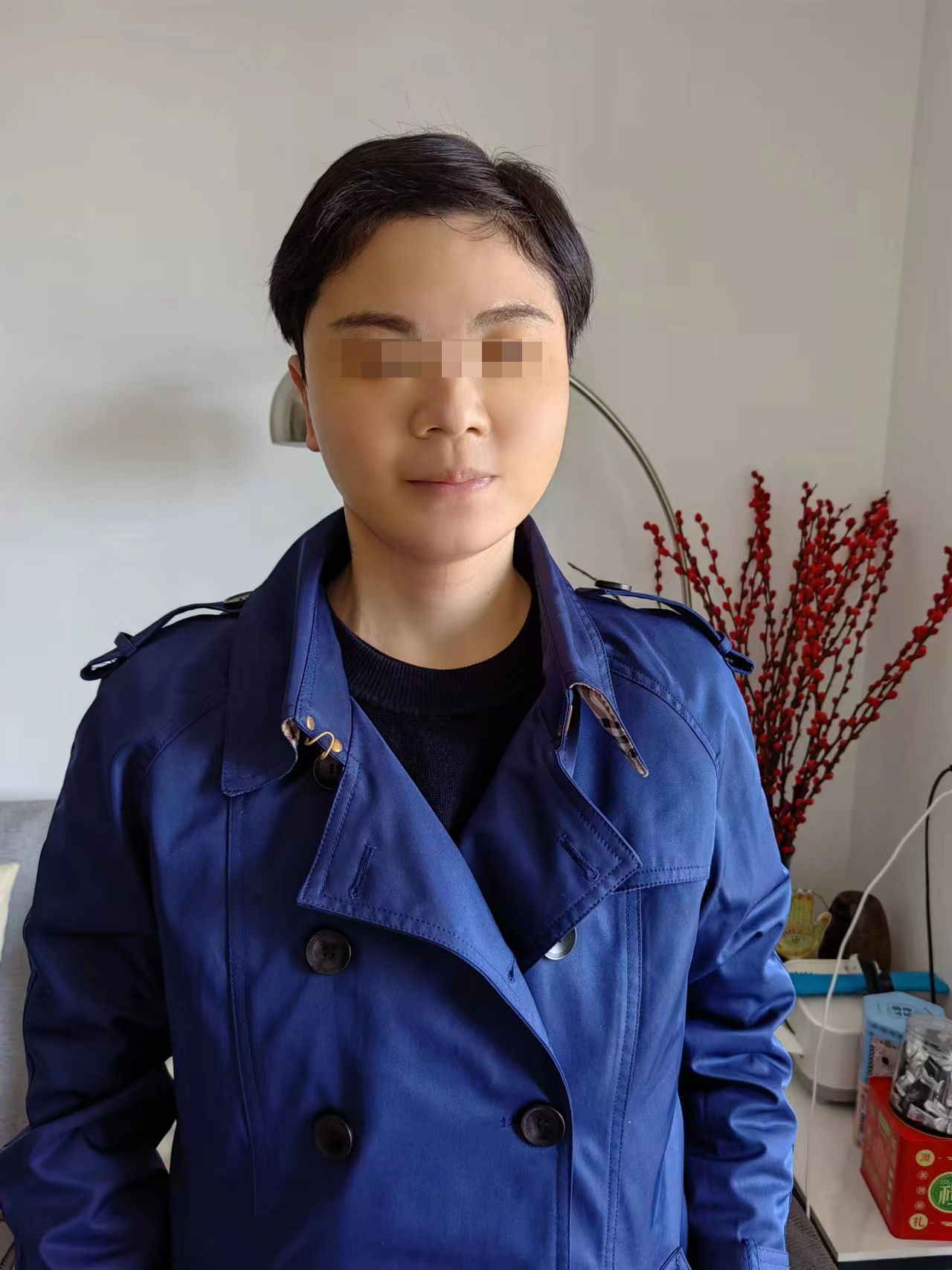 72年的,攒了几个月工资来的,不做拉皮不做线雕