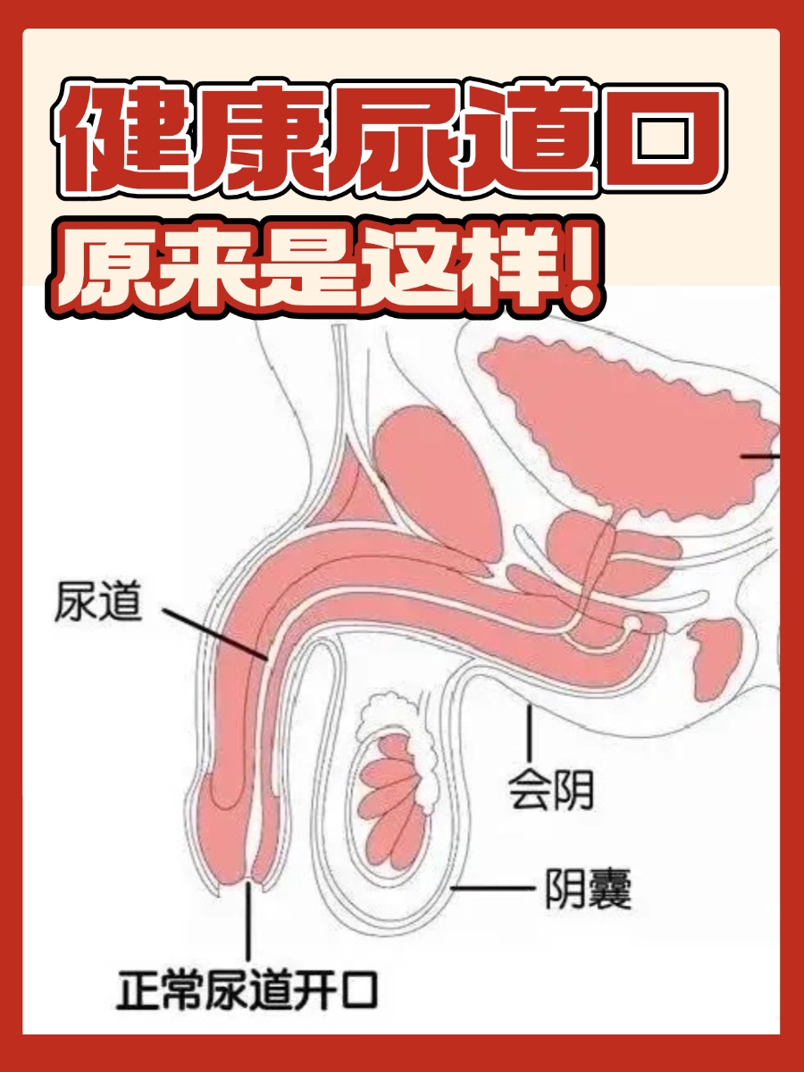 了解正常尿道口的外观和功能特点,对于及时发现潜在的异常情况