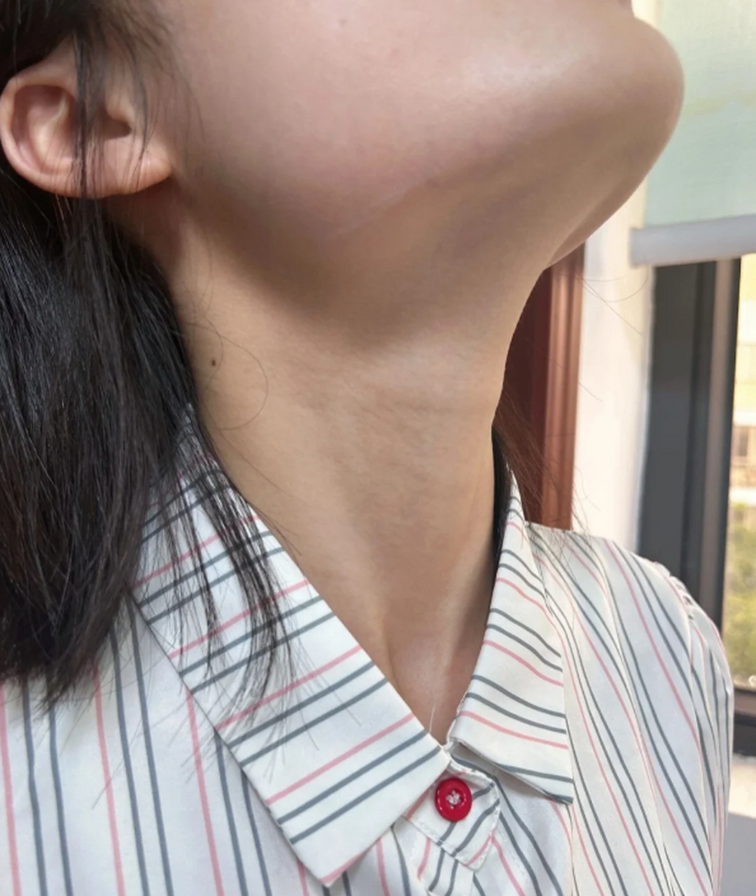 女性患上甲减时,可能会出现一系列症状,这些症状可以作为早期发现的