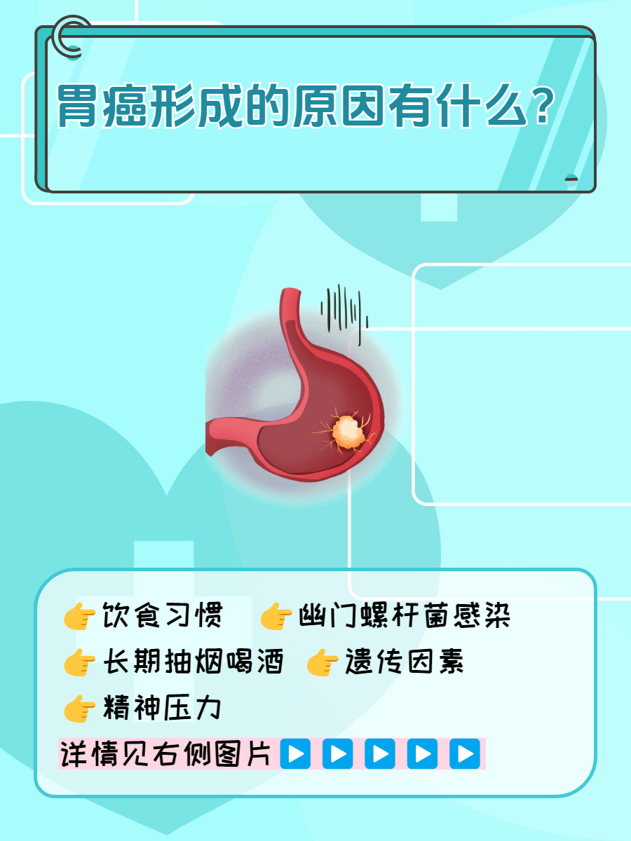 其实不然,很多日常小细节都有可能影响到胃癌的发生!