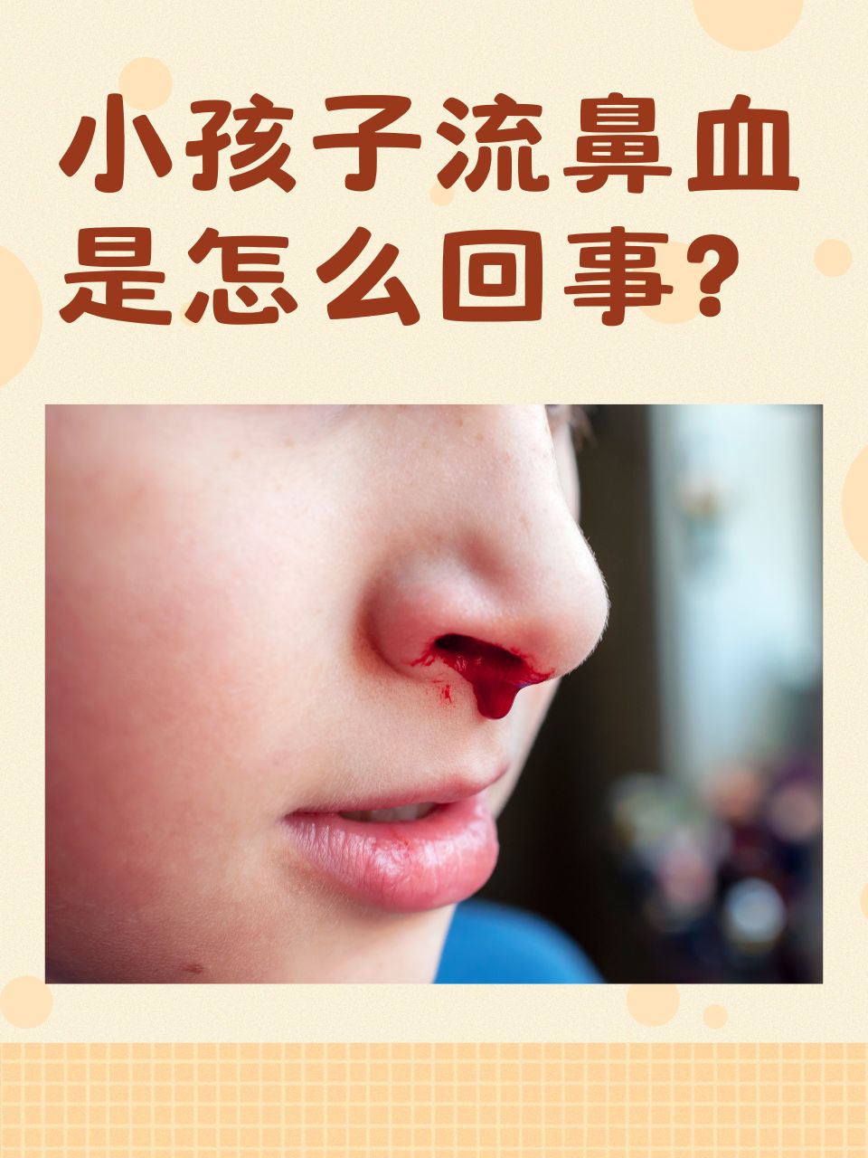 为什么小孩流鼻血