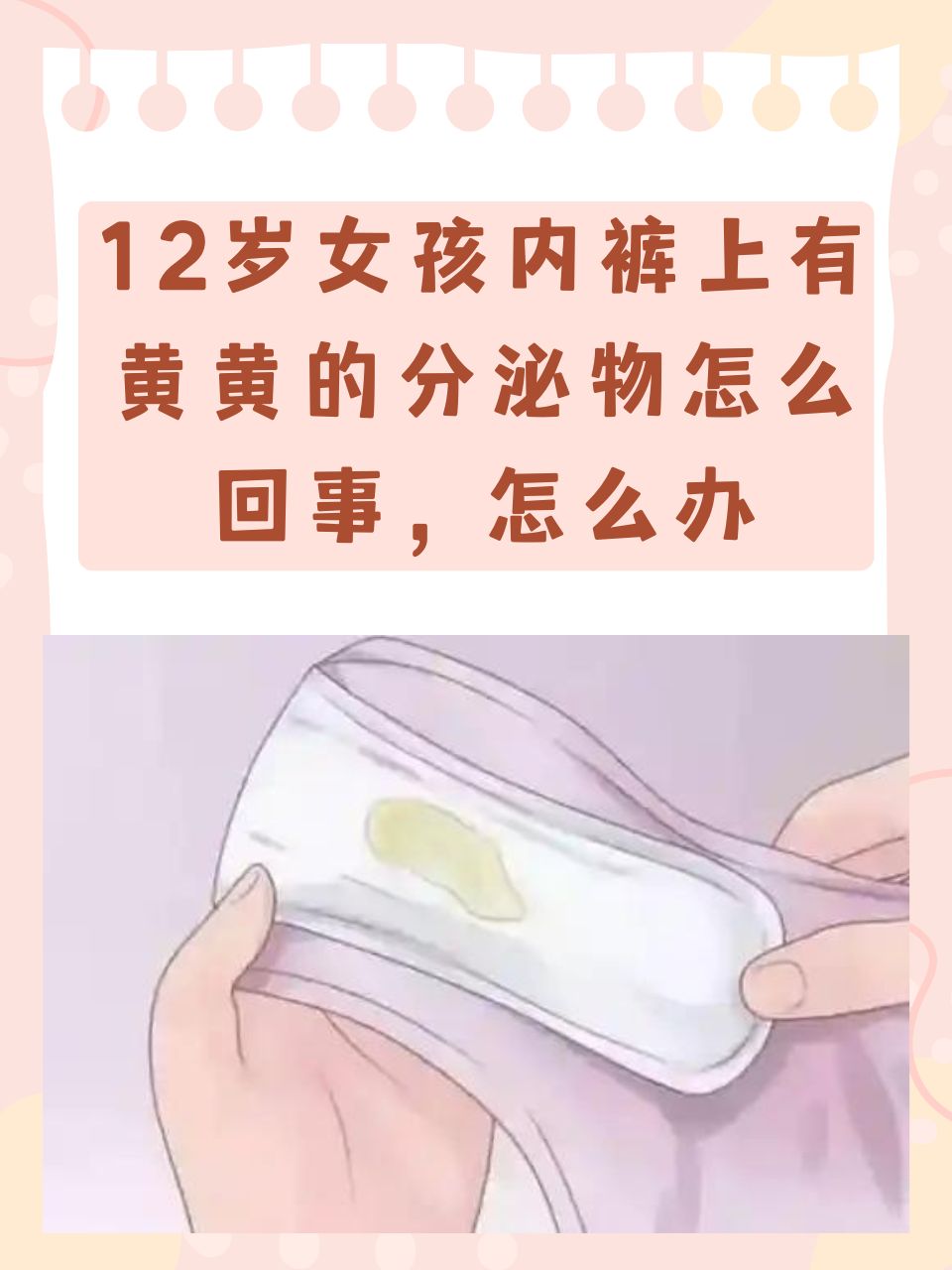 女性内裤发黄的原因图片