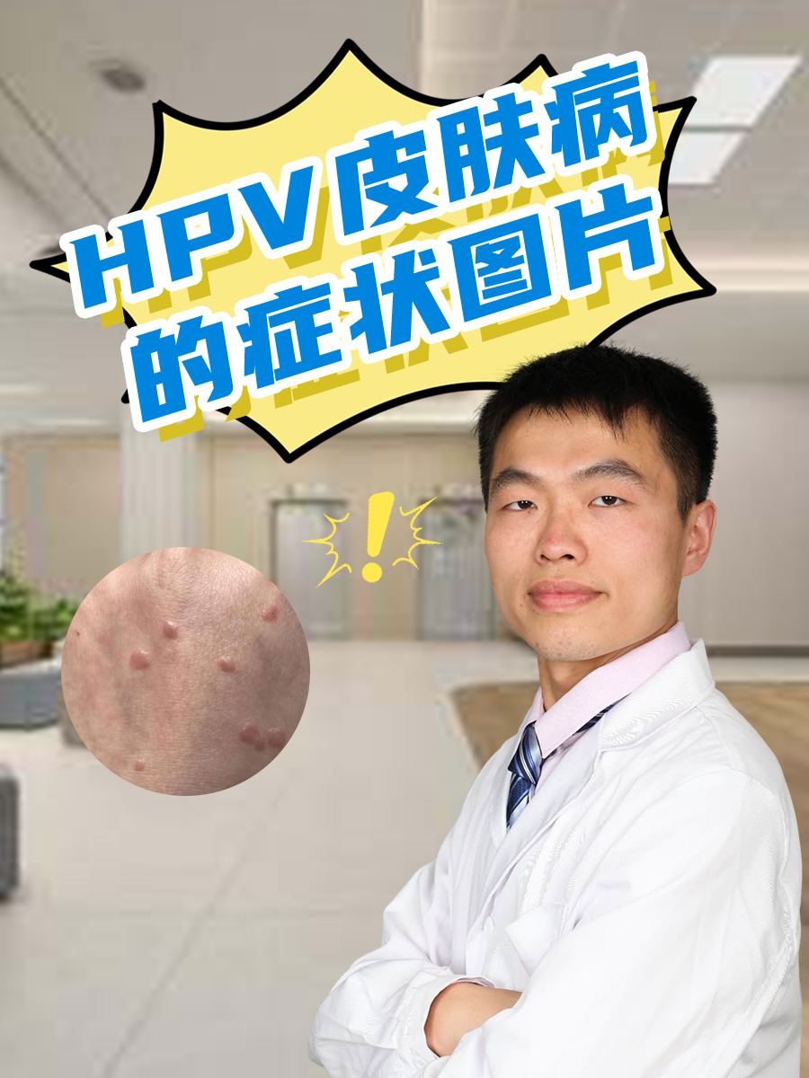 hpv表现图片