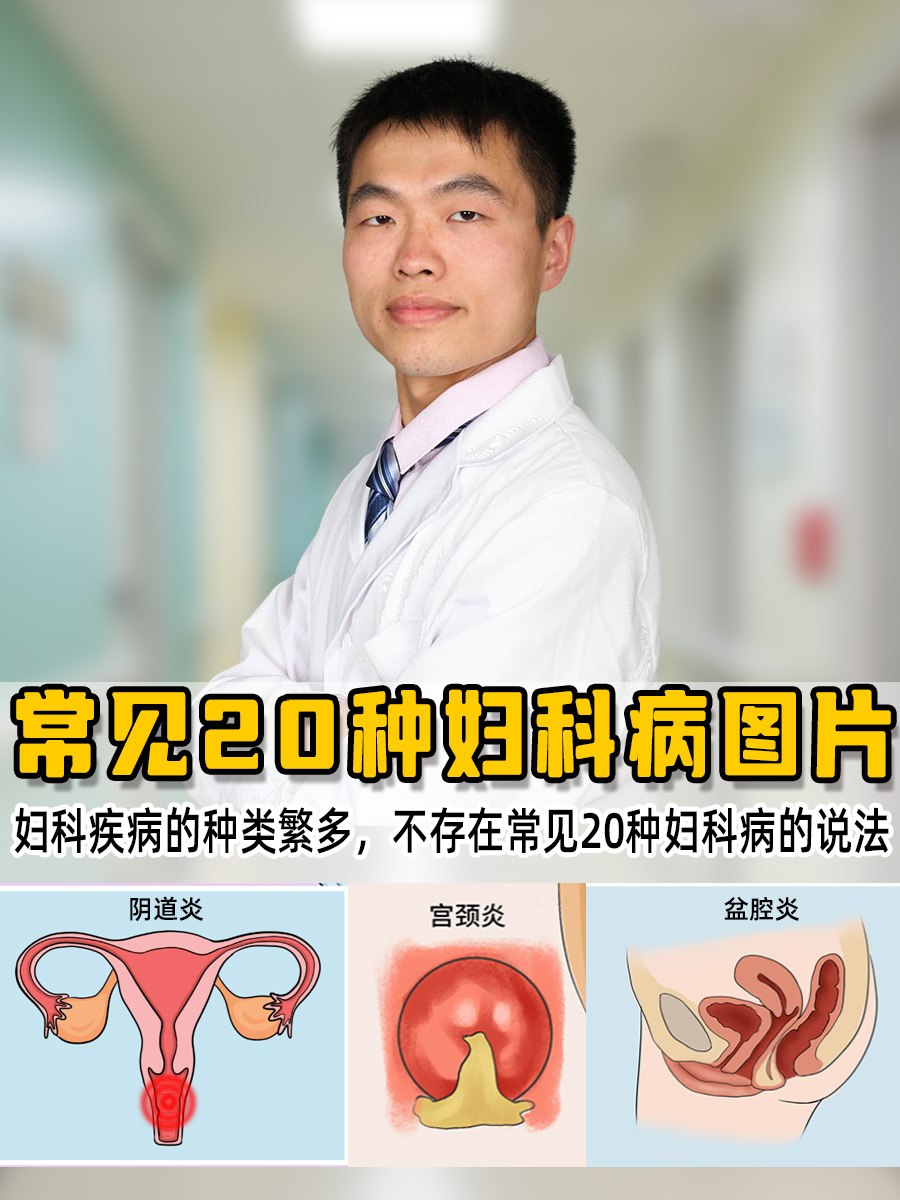 常见20种妇科病图片图片