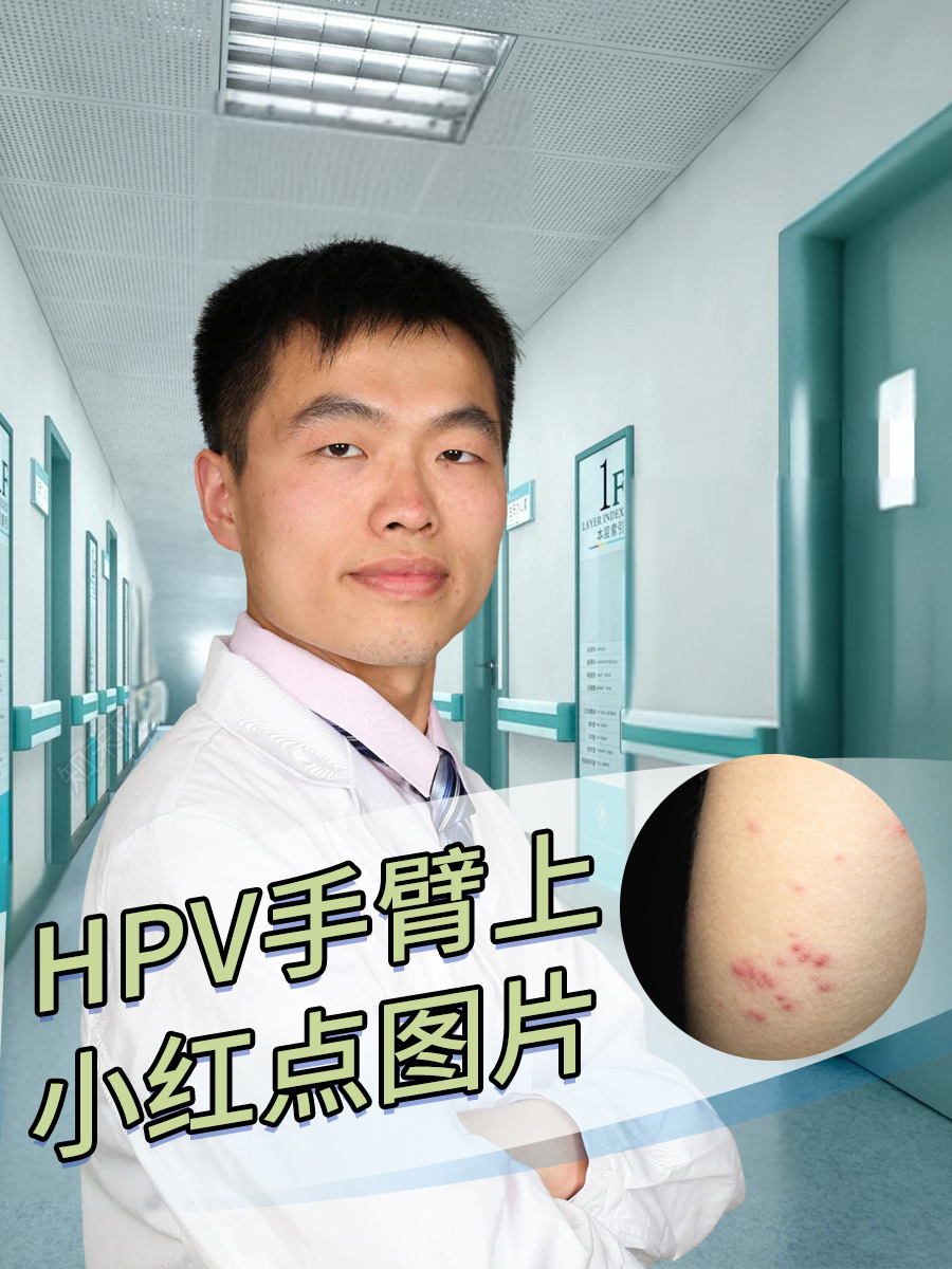 hpv小红点长什么样图片