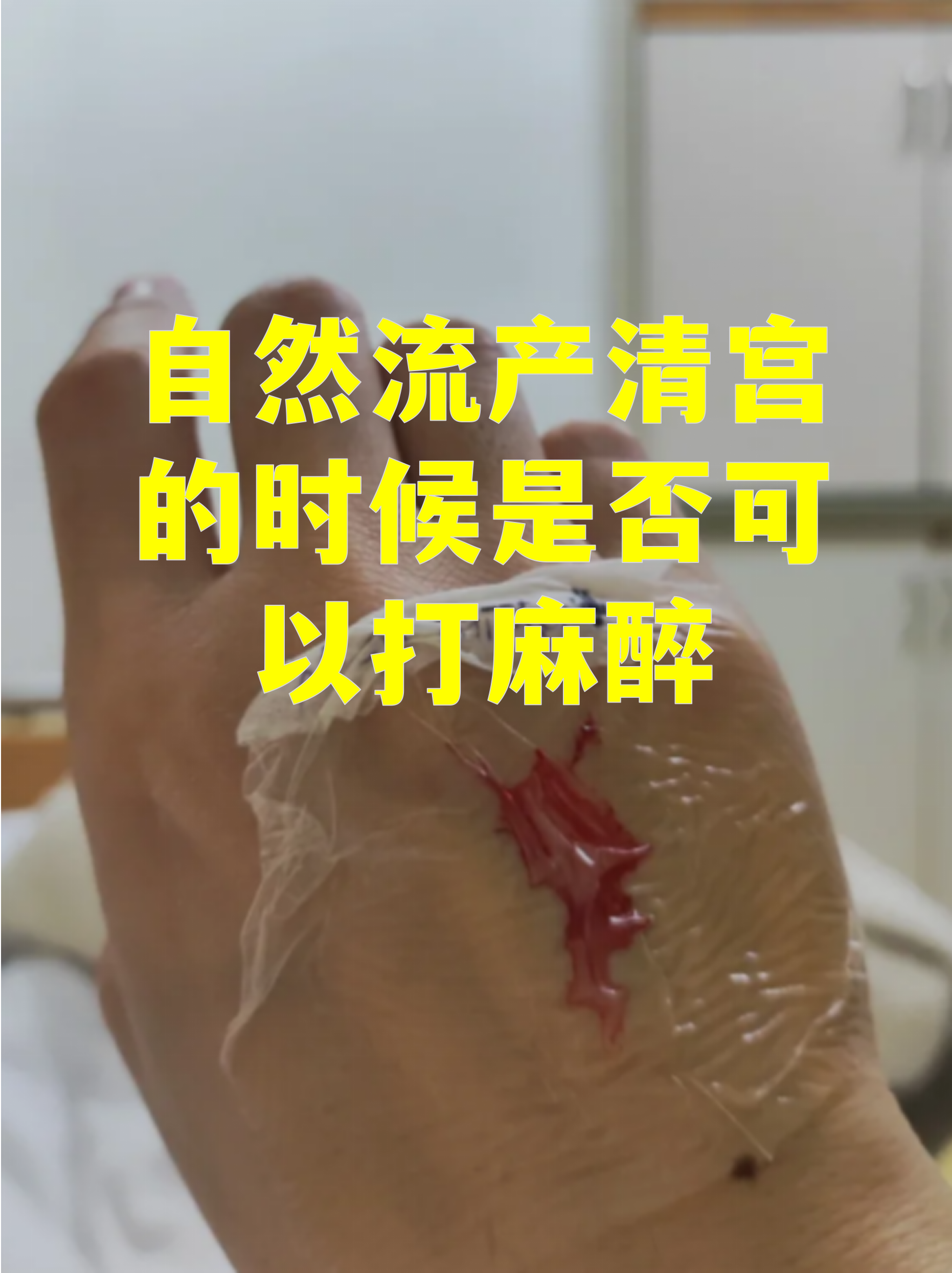 自然流产的需要超度吗-自然流产的婴灵要超度吗