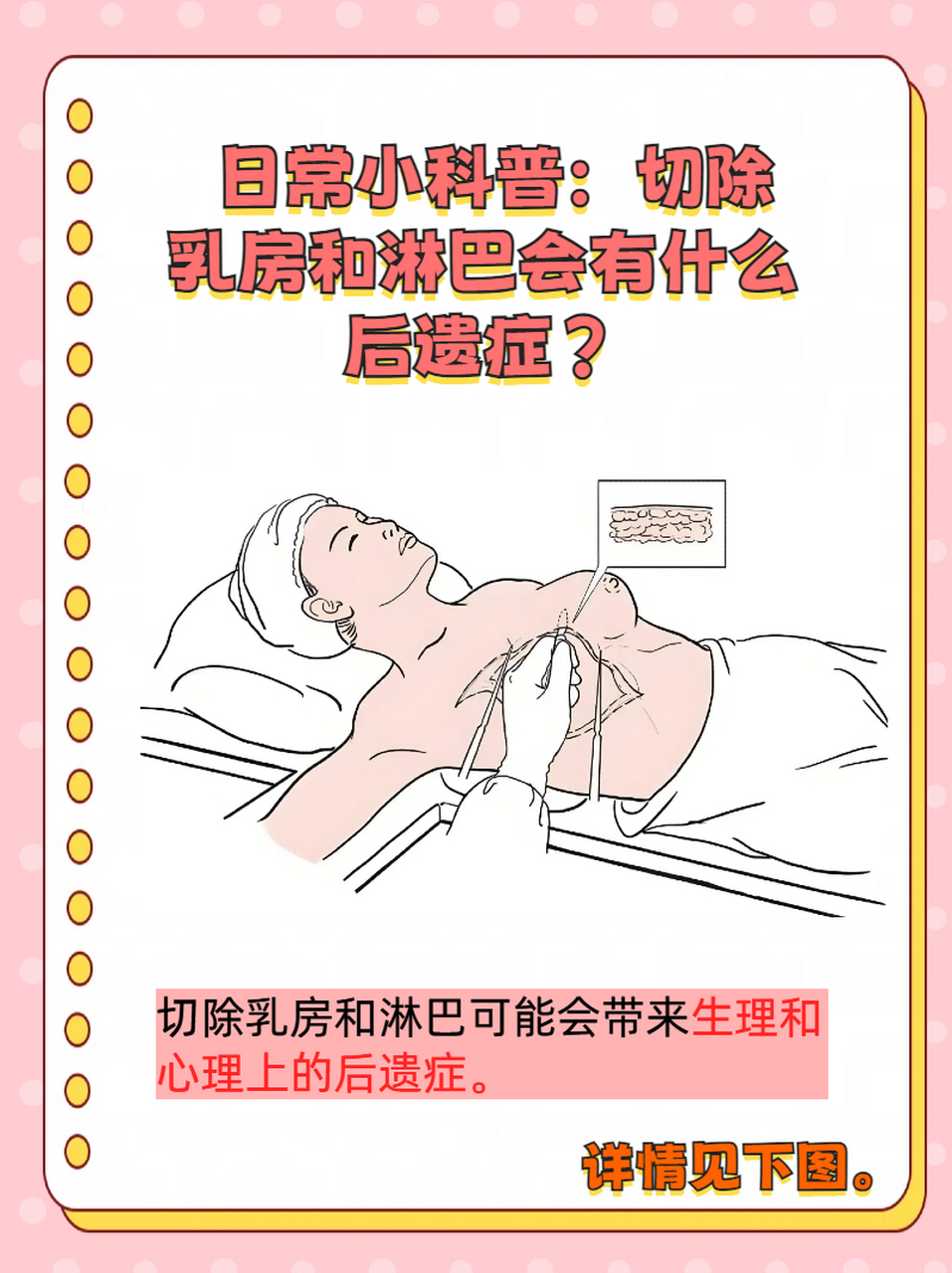 乳房象限切除术图片