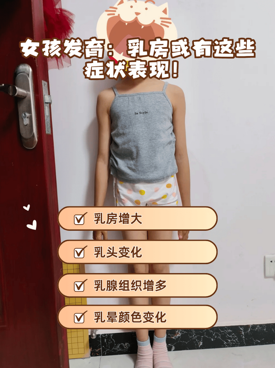 女孩发育:乳房或有这些症状表现!