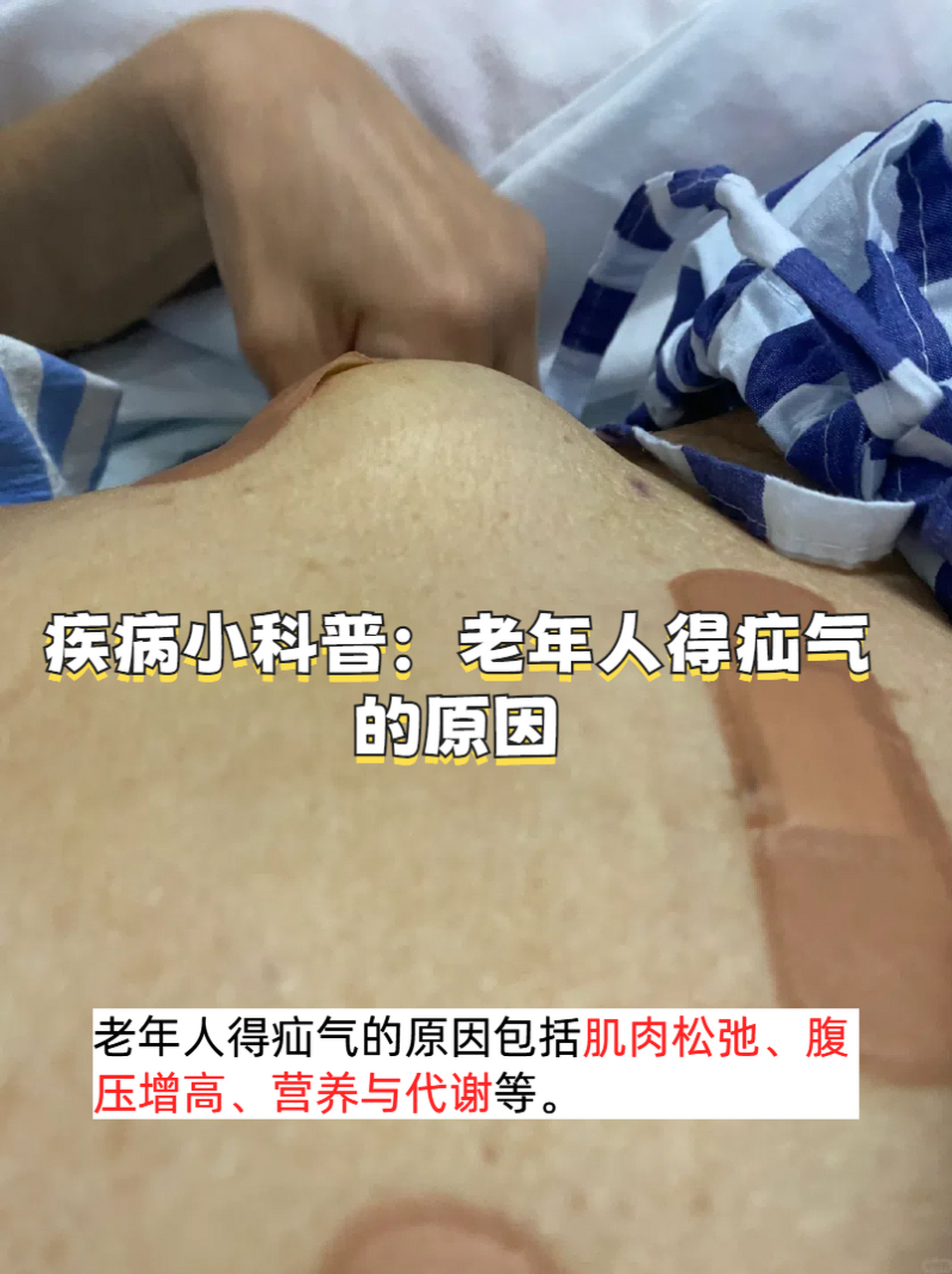 今天,我们就来聊聊老年人常见的健康问题之一——疝气.