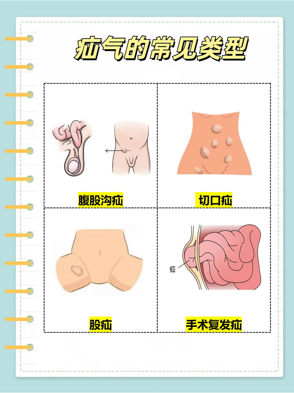 腹白线图片怀孕图片