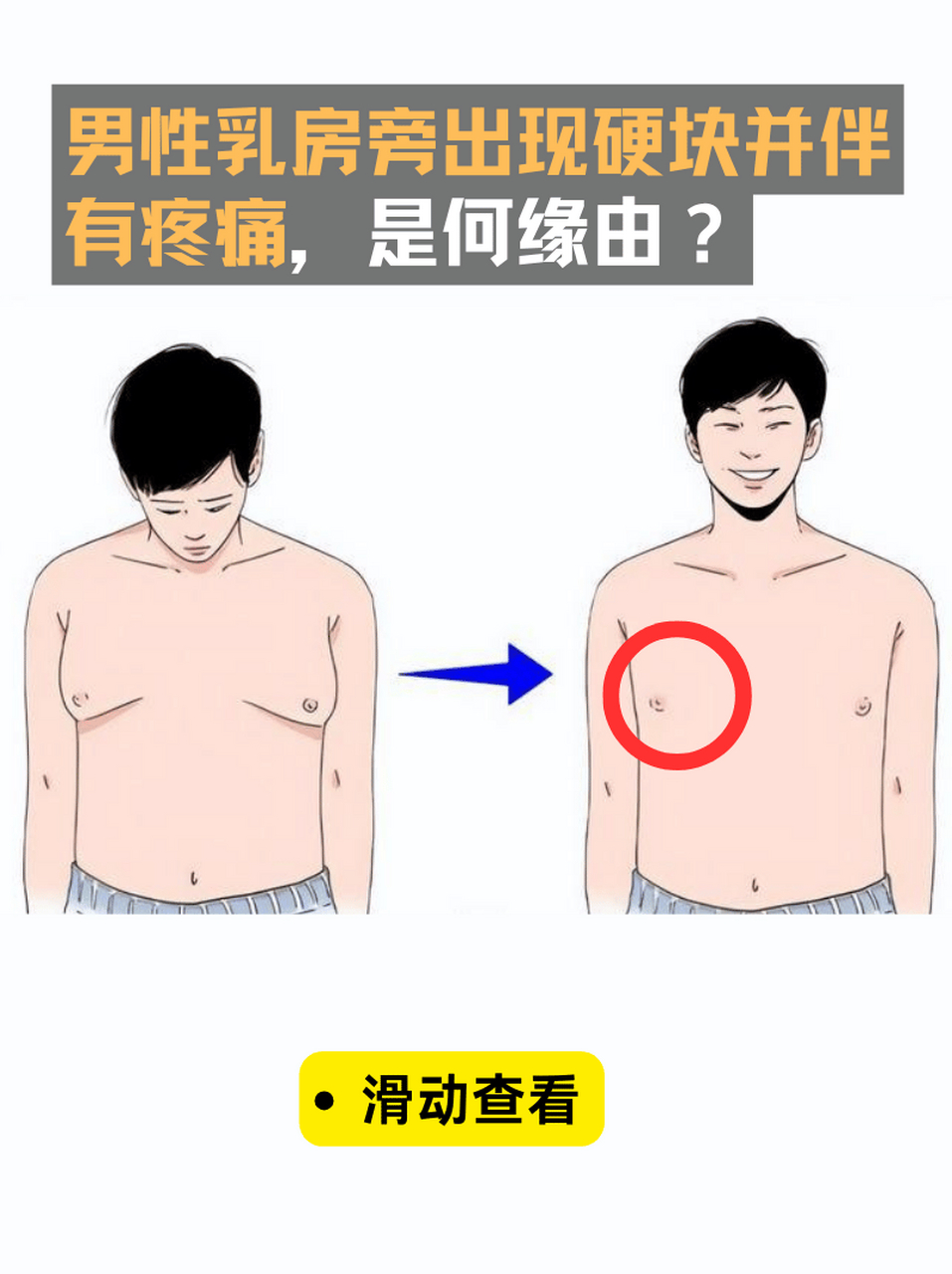 乳头疼男士图片