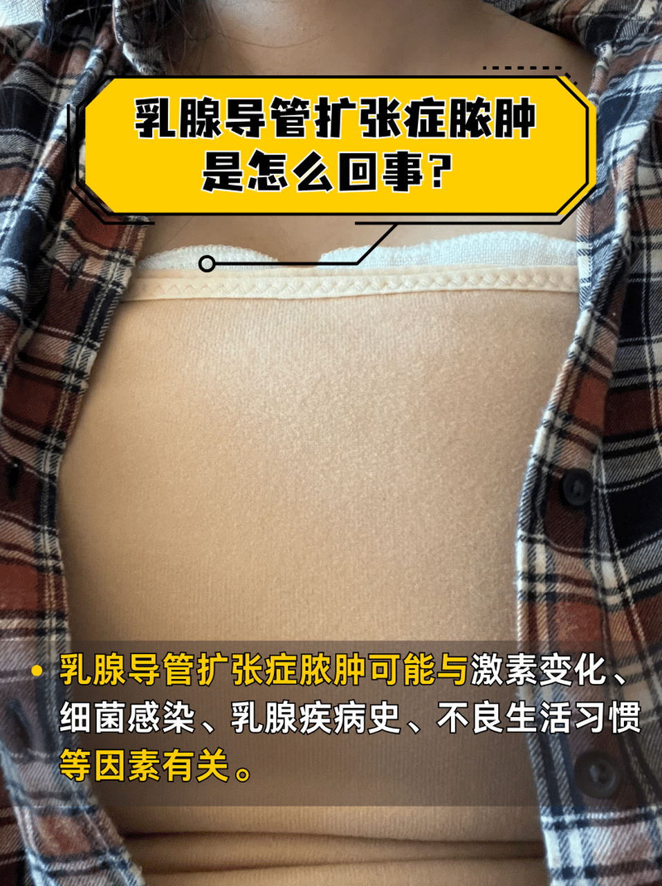 乳腺瘘管照片症状图片