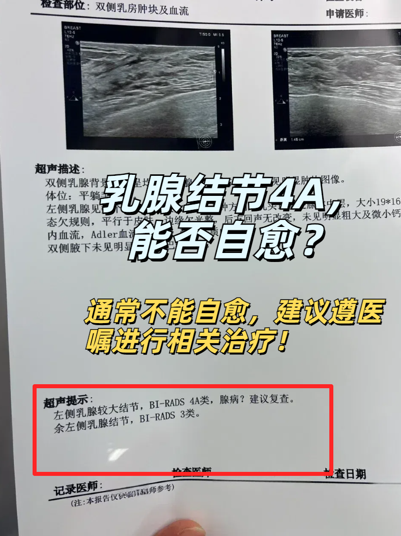 很遗憾地告诉大家,乳腺结节4a通常不能自愈