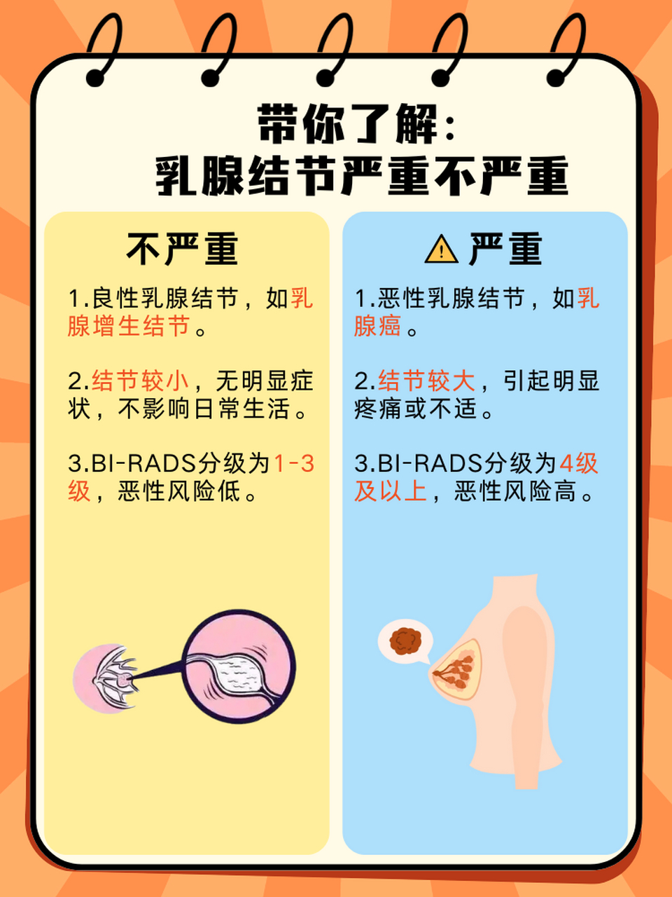 乳腺结节症状图片