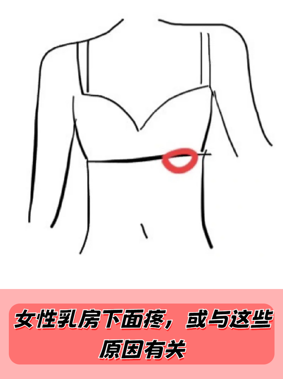 女性乳房下面疼,或与这些原因有关  7215有时候女性会突然间感觉