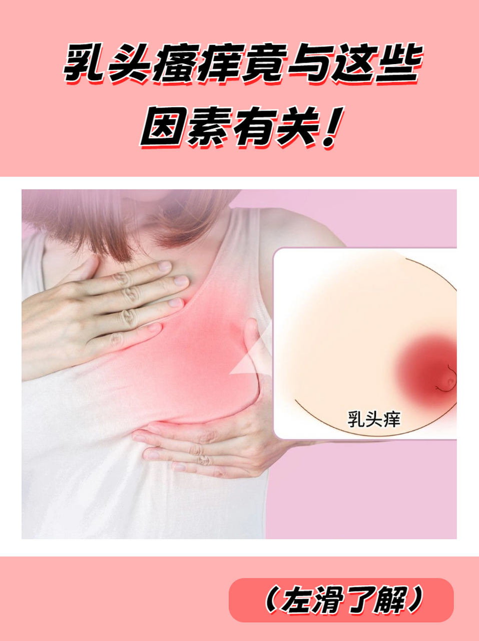 乳头瘙痒竟与这些因素有关!