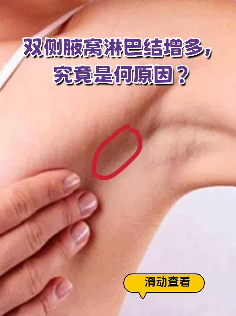 乳腺炎皮肤发红图片图片