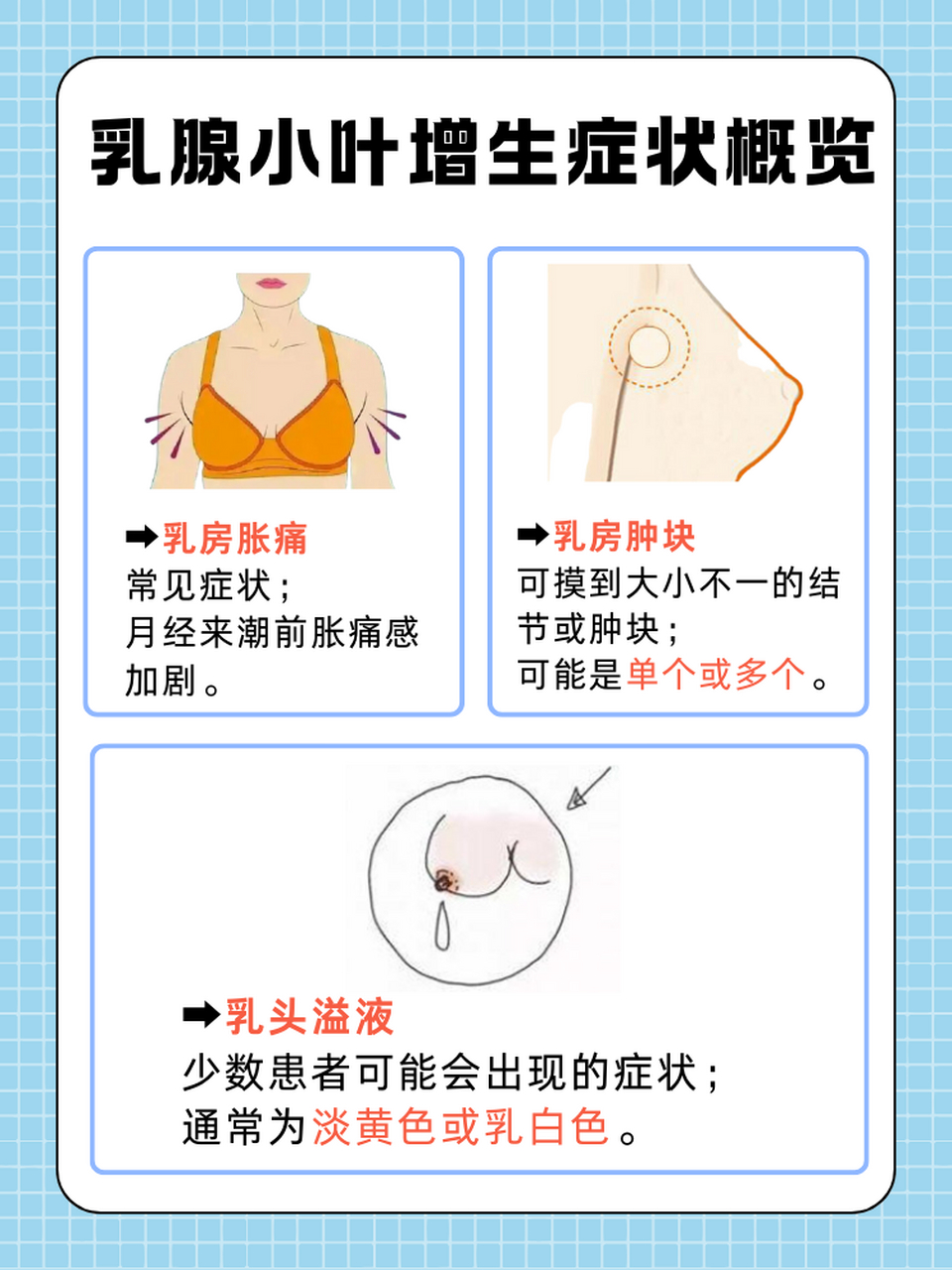 乳腺增生症现象图片