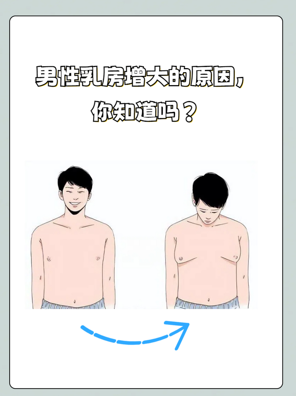 男性乳头突出图片