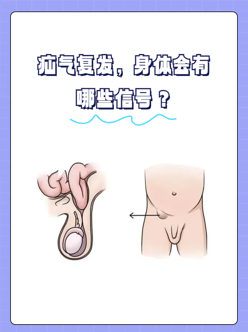 女孩疝气初期症状图片图片