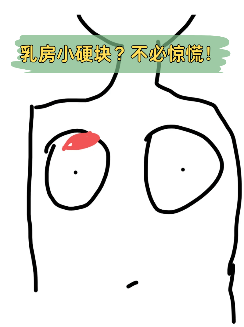 有时候突然发现乳房有个小硬块,是不是瞬间就慌了神?