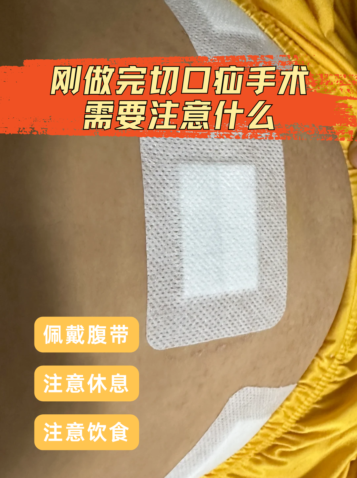 刚做完切口疝手术,需要注意什么  切口疝手术是疝气手术的一种,做完