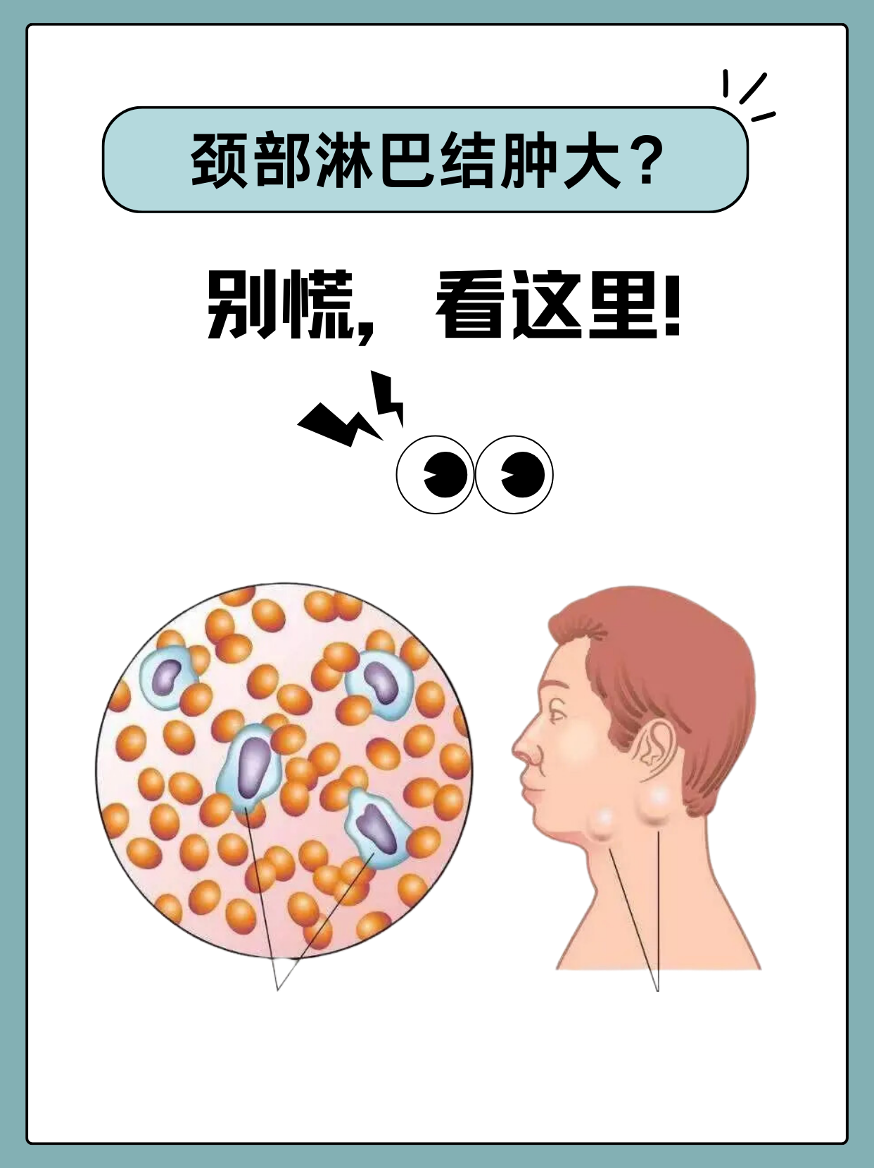 脖子为什么会长淋巴结