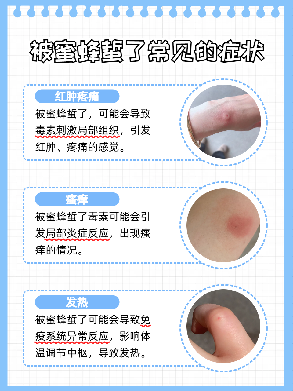 梦见被蜂蜜蛰是什么(梦见被蜂蜜咬)